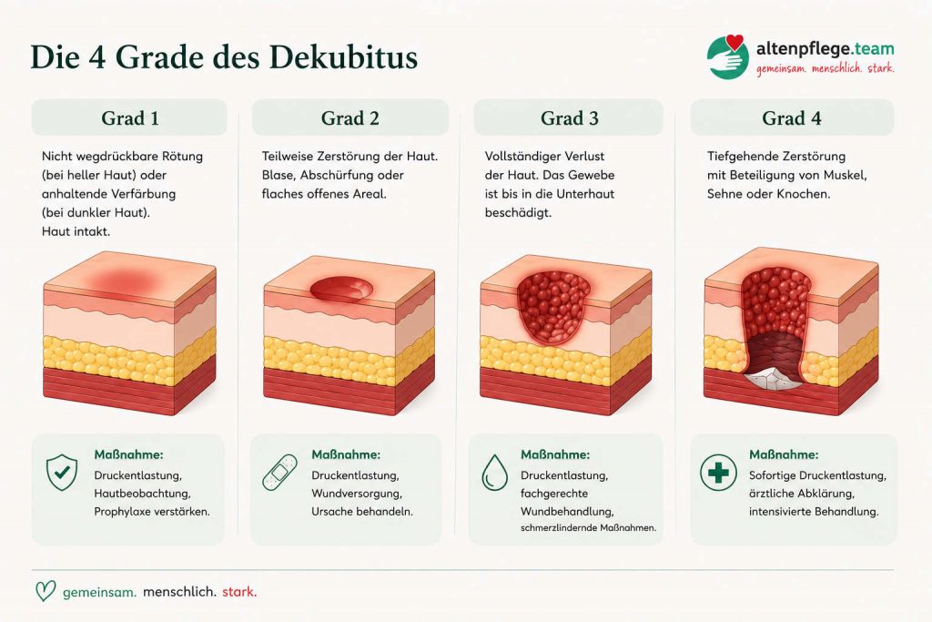 Die 4 Dekubitus-Grade