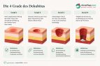 Die 4 Dekubitus-Grade