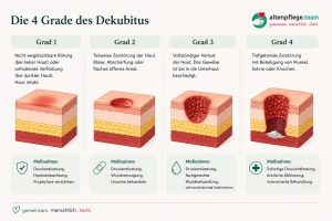 Die 4 Dekubitus-Grade